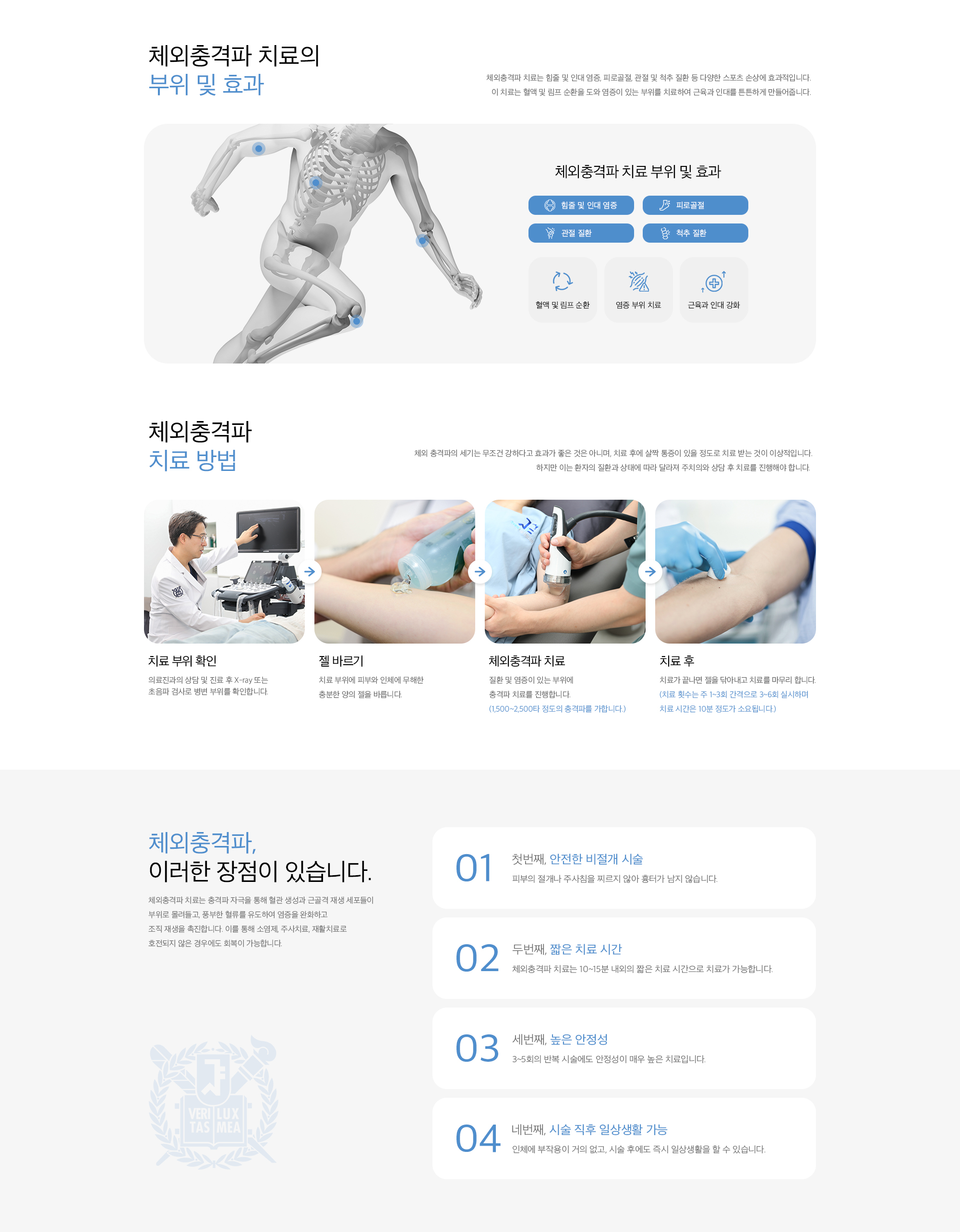 체외충격파 치료의 부위 및 효과