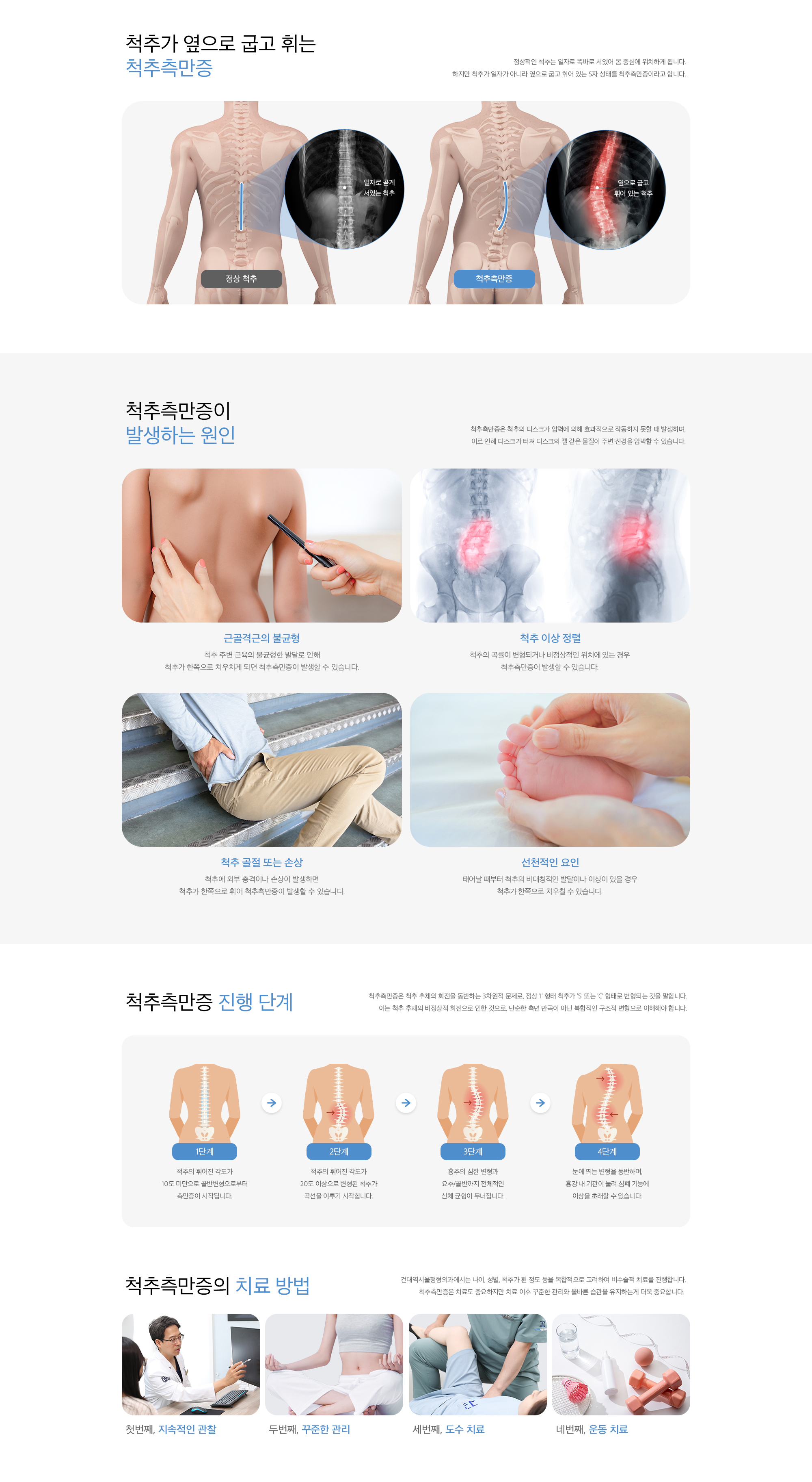 척추측만증